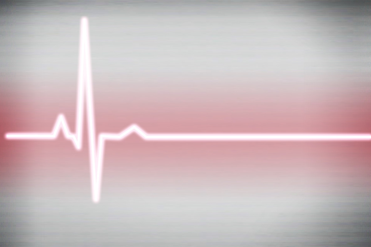 Cardiac Arrest