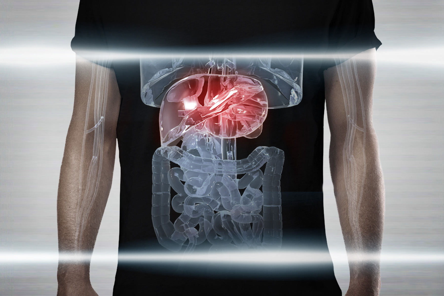 Acetaminophen Liver Damage