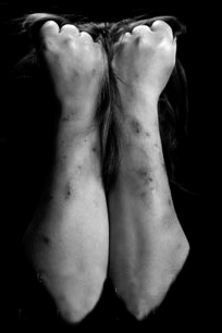 PCP Self Mutilation