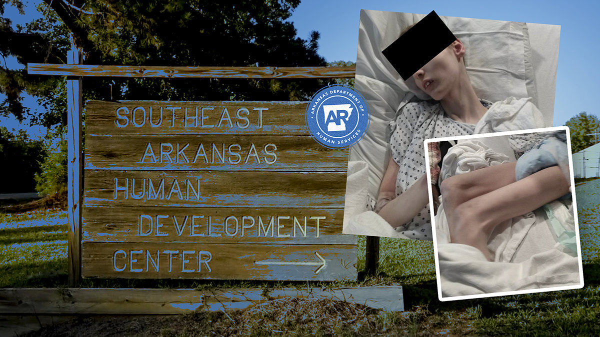 Arkansas Department of Human Services Liable for Neglect, Deaths in Human Development Centers