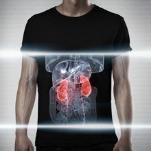 Kidneys