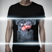 Pancreas