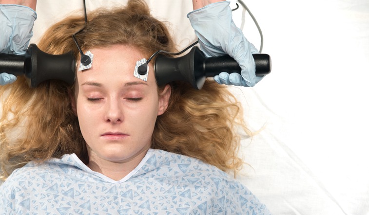 Shock Treatment: The Truth Behind Electroshock Therapy